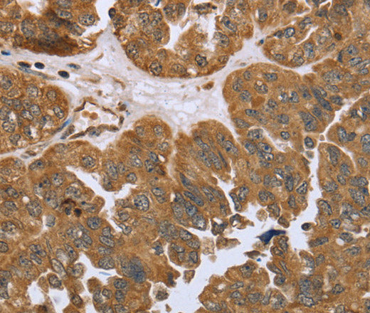 Anti-Human/Mouse IKBKE Antibody - ABMIUM