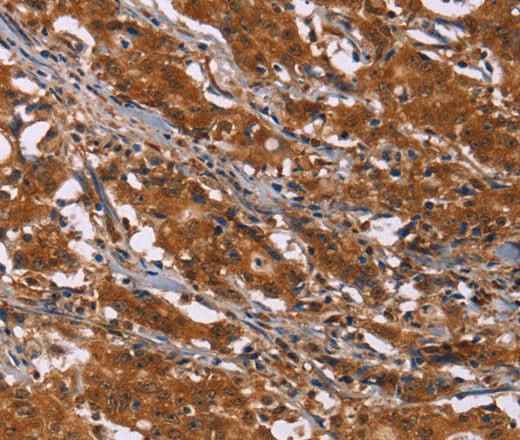 Anti-Human/Mouse/Rat DCBLD2 Antibody