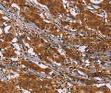 Anti-Human/Mouse/Rat DCBLD2 Antibody - ABMIUM