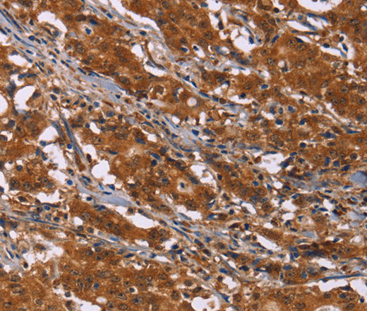 Anti-Human/Mouse/Rat DCBLD2 Antibody - ABMIUM