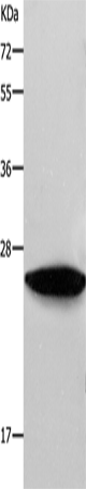 Anti-Human/Mouse RAB38 Antibody - ABMIUM
