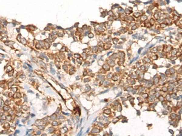 Anti-Human CA5B Antibody - ABMIUM