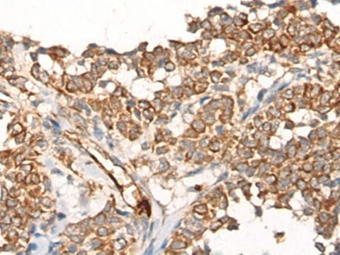 Anti-Human CA5B Antibody - ABMIUM