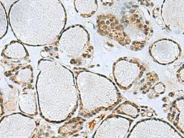 Anti-Human/Mouse PTPA Antibody