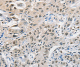 Anti-Human/Mouse/Rat CDC27 Antibody - ABMIUM