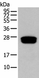 Western blot analysis of Human testis tissue using GLIPR1L1 Polyclonal Antibody at dilution of 1:300