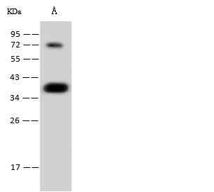 Anti-Human CGREF1 Antibody [B186] - ABMIUM