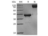 Recombinant Human BCMA/TNFRSF17 Protein (mFc Tag) - ABMIUM