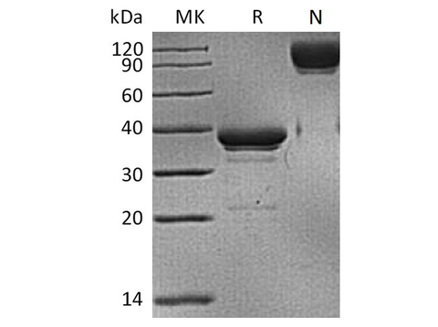 Recombinant Human BCMA/TNFRSF17 Protein (mFc Tag) - ABMIUM