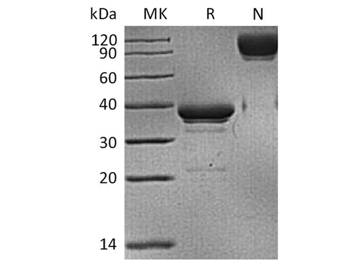 Recombinant Human BCMA/TNFRSF17 Protein (mFc Tag) - ABMIUM