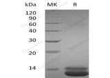 Recombinant Human CXCL1 Protein (His Tag) - ABMIUM