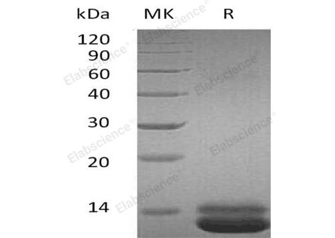 Recombinant Human CXCL1 Protein (His Tag) - ABMIUM