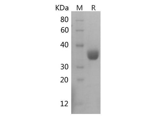 SDS-PAGE analysis of Human PDL1/CD274 proteins, 2 μg/lane of Recombinant Human PDL1/CD274 proteins was resolved with SDS-PAGE under reducing conditions, showing bands at 36 kDa.