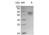 Recombinant Mouse PD-L1/B7-H1/CD274 Protein (His Tag) - ABMIUM