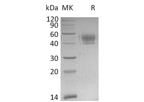 Recombinant Mouse PD-L1/B7-H1/CD274 Protein (His Tag) - ABMIUM