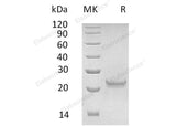 Recombinant Human Interferon ω-1/IFNW1 Protein (His Tag) - ABMIUM
