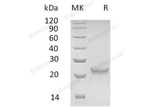Recombinant Human Interferon ω-1/IFNW1 Protein (His Tag) - ABMIUM