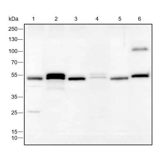 Anti-Human/Rat/Mouse FLI1 Antibody [A222]