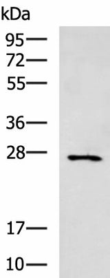 Western blot analysis of Mouse small intestines tissue lysate using CIDEC Polyclonal Antibody at dilution of 1:400