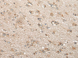 Immunohistochemistry of paraffin-embedded Human brain tissue using BCHE Polyclonal Antibody at dilution of 1:60(×200)