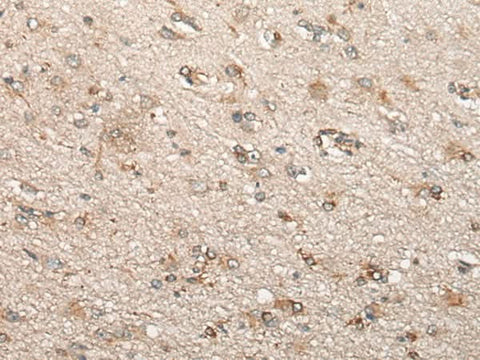 Immunohistochemistry of paraffin-embedded Human brain tissue using BCHE Polyclonal Antibody at dilution of 1:60(×200)