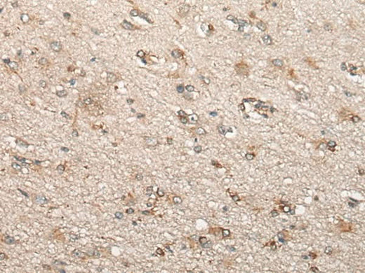 Immunohistochemistry of paraffin-embedded Human brain tissue using BCHE Polyclonal Antibody at dilution of 1:60(×200)
