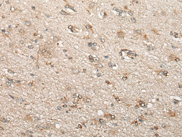 Immunohistochemistry of paraffin-embedded Human brain tissue using BCHE Polyclonal Antibody at dilution of 1:60(×200)