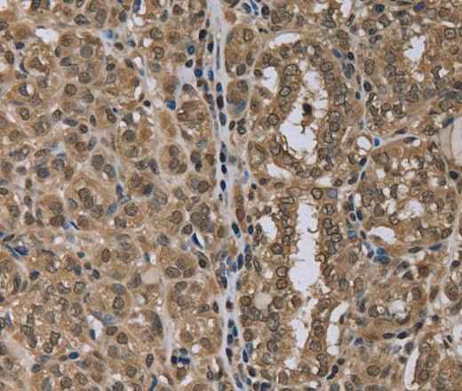 Anti-Human NLRP6 Antibody