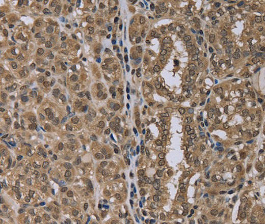 Anti-Human NLRP6 Antibody - ABMIUM
