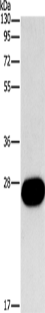 Anti-Human/Mouse/Rat FGF9 Antibody - ABMIUM