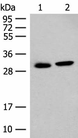 Western blot analysis of Mouse kidney tissue and Human kidney tissue lysates using GLYAT Polyclonal Antibody at dilution of 1:300