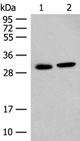 Western blot analysis of Mouse kidney tissue and Human kidney tissue lysates using GLYAT Polyclonal Antibody at dilution of 1:300