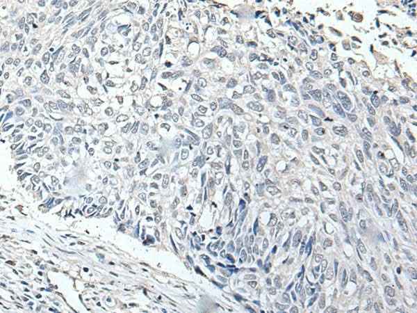 Anti-Human/Mouse RERG Antibody