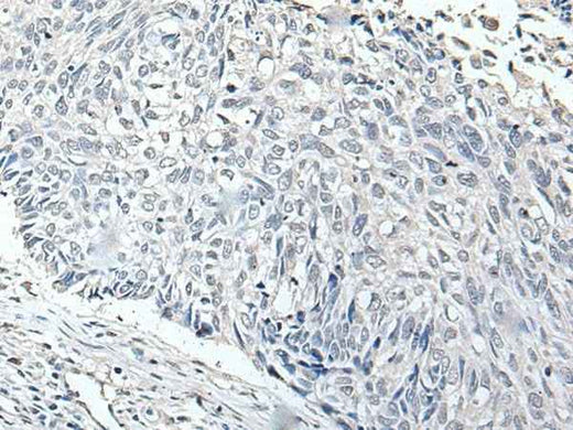 Anti-Human/Mouse RERG Antibody