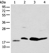 Anti-Human BCL2 Antibody - ABMIUM