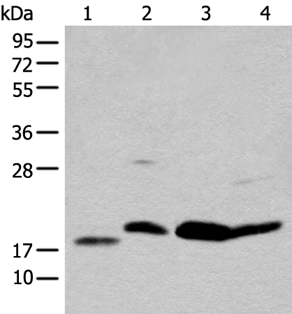 Anti-Human BCL2 Antibody - ABMIUM