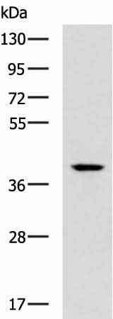 Anti-Human/Mouse TDP2 Antibody