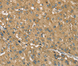 Anti-Human RNF148 Antibody - ABMIUM