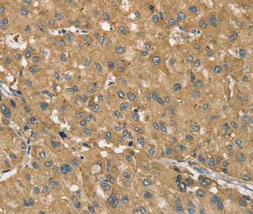 Anti-Human RNF148 Antibody