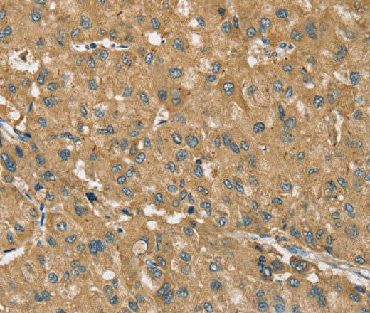 Anti-Human RNF148 Antibody - ABMIUM