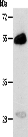 Anti-Human/Mouse CA14 Antibody - ABMIUM