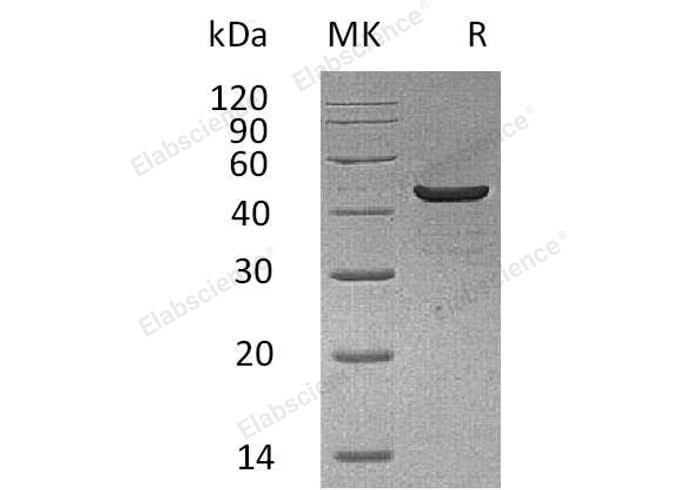 Recombinant Human Creatine Kinase, Muscle/CKM Protein (His Tag) - ABMIUM