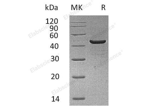 Recombinant Human Creatine Kinase, Muscle/CKM Protein (His Tag) - ABMIUM