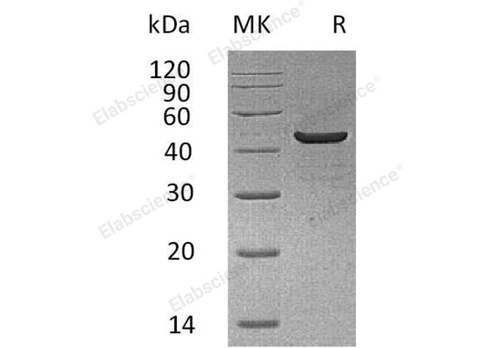 Recombinant Human Creatine Kinase, Muscle/CKM Protein (His Tag) - ABMIUM