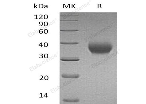 Recombinant Human IL-2RB/CD122 Protein (His Tag) - ABMIUM
