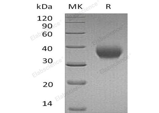 Recombinant Human IL-2RB/CD122 Protein (His Tag) - ABMIUM