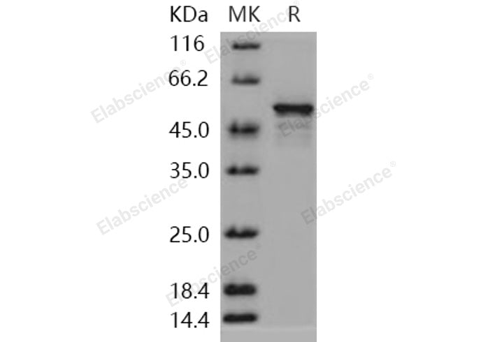 Recombinant Human DOT1L/KMT4 Protein - ABMIUM