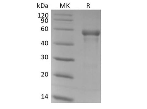 Recombinant Human B3GAT1 (N-6His) - ABMIUM