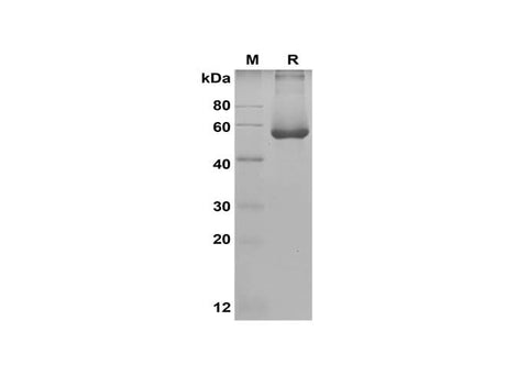 SDS-PAGE analysis of Human ALDH1A2 proteins, 2 μg/lane of Recombinant Human ALDH1A2 proteins was resolved with SDS-PAGE under reducing conditions, showing bands at 55 kDa.