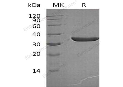 Recombinant Human PSA/KLK3 Protein (aa 25-261, His Tag) - ABMIUM